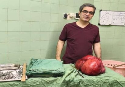 خارج کردن توده سنگین از شکم بیمار پس از سال‌ها درد